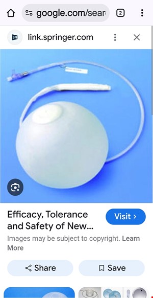 بالون لاغری معده سیلیکونی مدیکون 